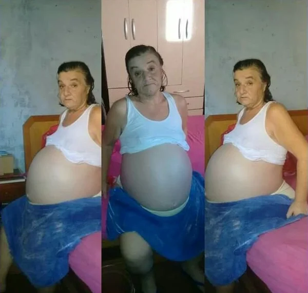 Filha pede ajuda para operar mãe com tumor no ovário
