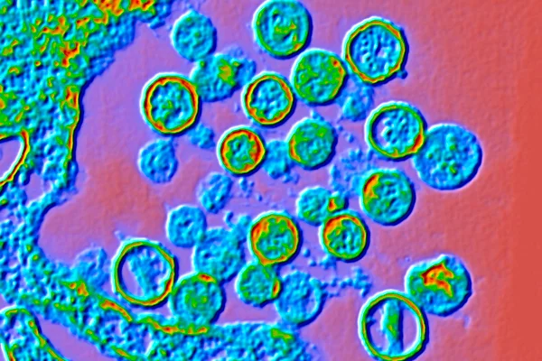 Micrografia eletrônica de transmissão (TEM) colorida de partículas de Hantavírus. Metrópoles