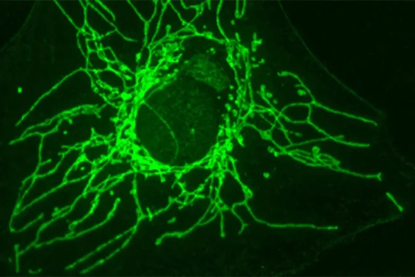 Célula cancerosa com mitocôndrias em verde — as centrais de energia da célula e locais de produção de clusters de ferro-enxofre. Metrópoles
