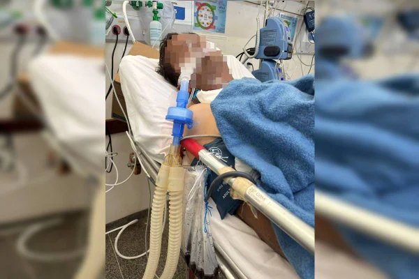 Foto colorida da vítima que foi agredida hospitalizada