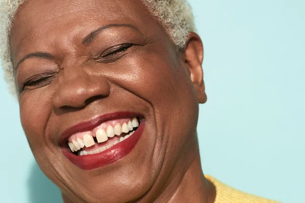 Imagem mostra close do rosto de uma mulher negra sorrindo - Metrópoles