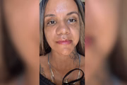 Mulher agredida com 61 socos mostra resultado de reconstrução facial
