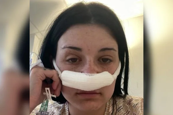 Foto colorida de mulher com curativo no nariz - Metrópoles.