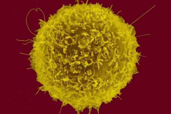 foto microscópica de uma célula, identificada como célula T, com fundo roxo e circulo enorme de cor verde - Metrópoles.