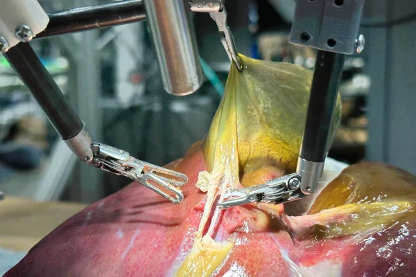 Robõ faz cirurgia sozinho sem humanos