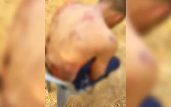 imagem colorida suspeito de furto corpo queimado goias