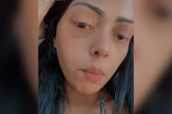 Glenielle Lourenço agredida em Minas