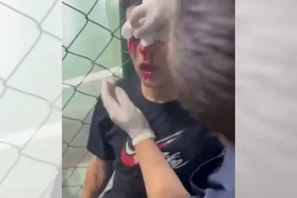 Imagem do jogador recebendo atendimento após explosão - Metrópoles