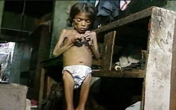 Após 25 anos, menina desnutrida que chocou país ainda vive na miséria