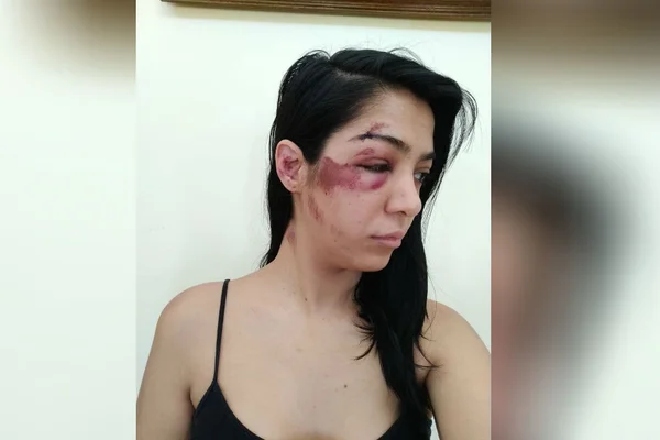 “Me derrubou e desmaiei”, diz advogada do DF sobre agressão