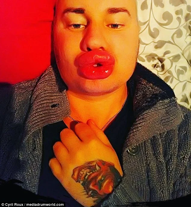 O que deixou a boca do rapaz assim O que deixou a boca do rapaz assim