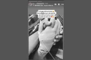 Amiga de Bruna, 30, morta após ingerir bebida adulterada por metanol, posta homenagem nas redes sociais