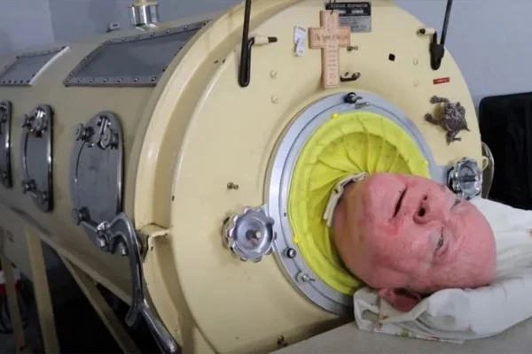 Paul Alexander dentro do pulmão de ferro - Metrópoles