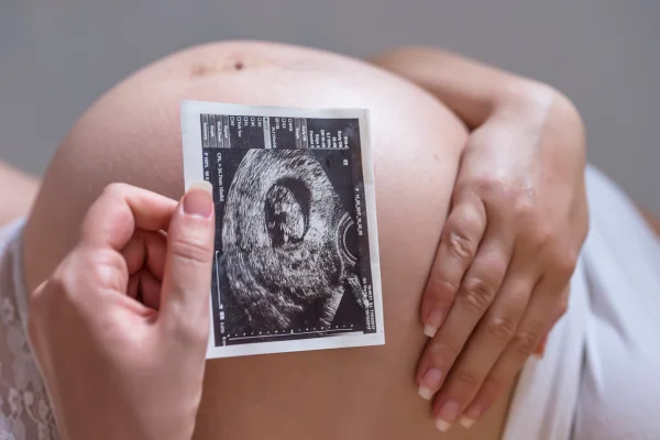 Foto colorida de mulher grávisa segurando uma foto de ultrassom em frente a barriga - Metrópoles.