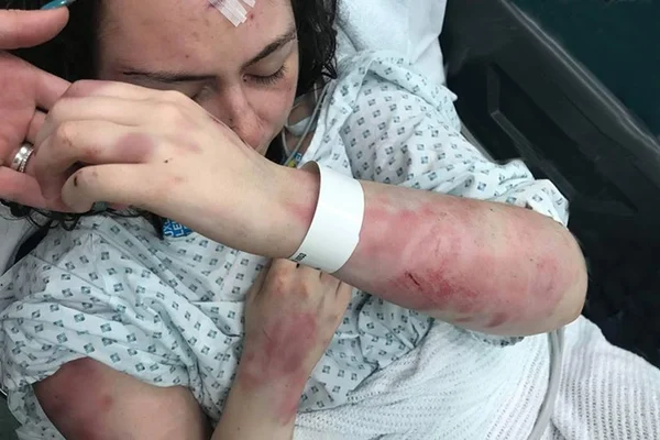 Jovem é espancada com taco de beisebol e estrangulada em encontro