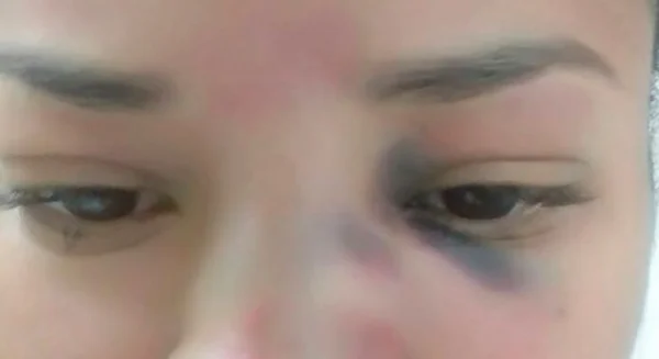 “Pensei que fosse morrer”, desabafa mulher espancada por marido no DF
