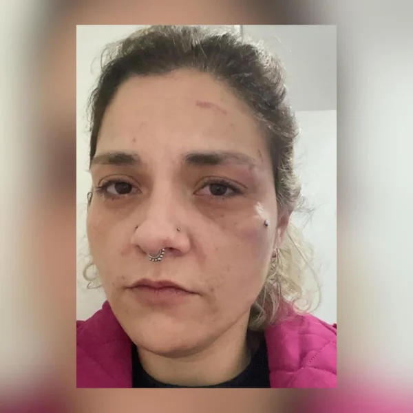 Mayara Calderone, ex-mulher do diretor de bateria da escola de samba Gaviões da Fiel, que foi agredida por ele em SP