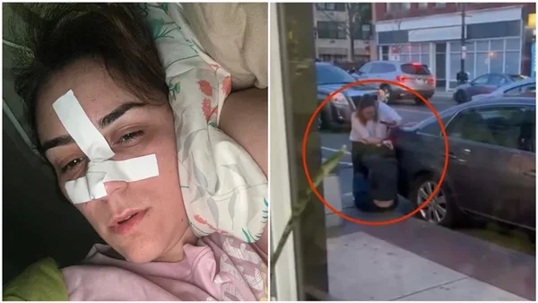 Montagem do rosto da brasileira espancada nos EUA (a esquerda) e momento da agressão (a direita) - Metrópoles