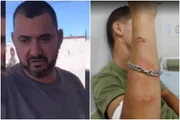 Ex-vereador agride frentista e o acusa de ter abastecido o carro dele com água
