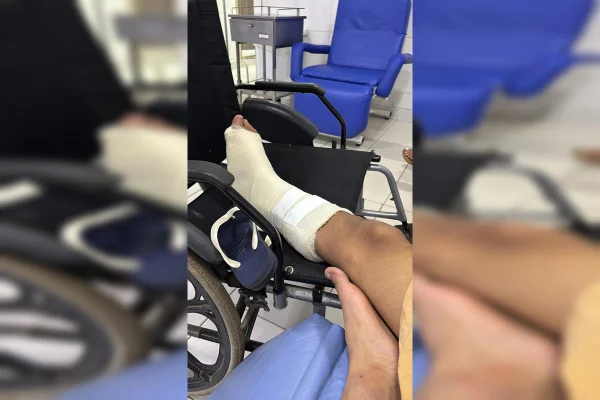 Foto colorida de pé enfaixado