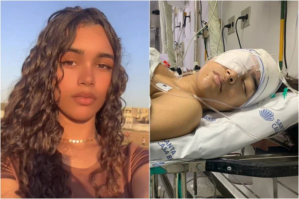 Imagem mostra duas fotos: na primeira, adolescente séria olhando para a câmera; na segunda, mesma adolescente em maca de hospital com tapão no olho - Metrópoles