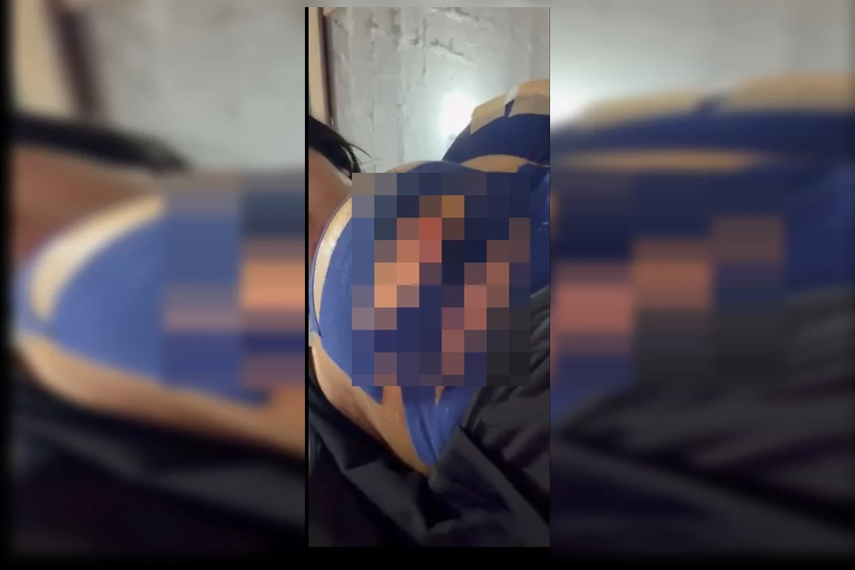 Vitória enfrentou diversas complicações, incluindo a abertura dos pontos em ambas as mamas e da região da abdominoplastia Vitória enfrentou diversas complicações, incluindo a abertura dos pontos em ambas as mamas e da região da abdominoplastia