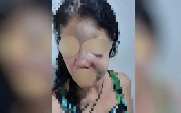 Mulher é agredida pelo namorado em Jaraguá, Goiás