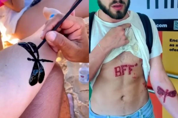Médica faz alerta sobre perigo das tatuagens de henna, comuns no verão
