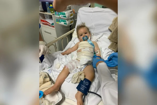 Imagem mostra criança enfaixada em cama de hospital - Metrópoles