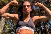 Karyn tem ausência quase total de gordura sob a pele