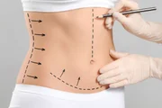 Segurança na cirurgia plástica depende de 7 cuidados fundamentais - imagem 5 Segurança na cirurgia plástica depende de 7 cuidados fundamentais - imagem 5