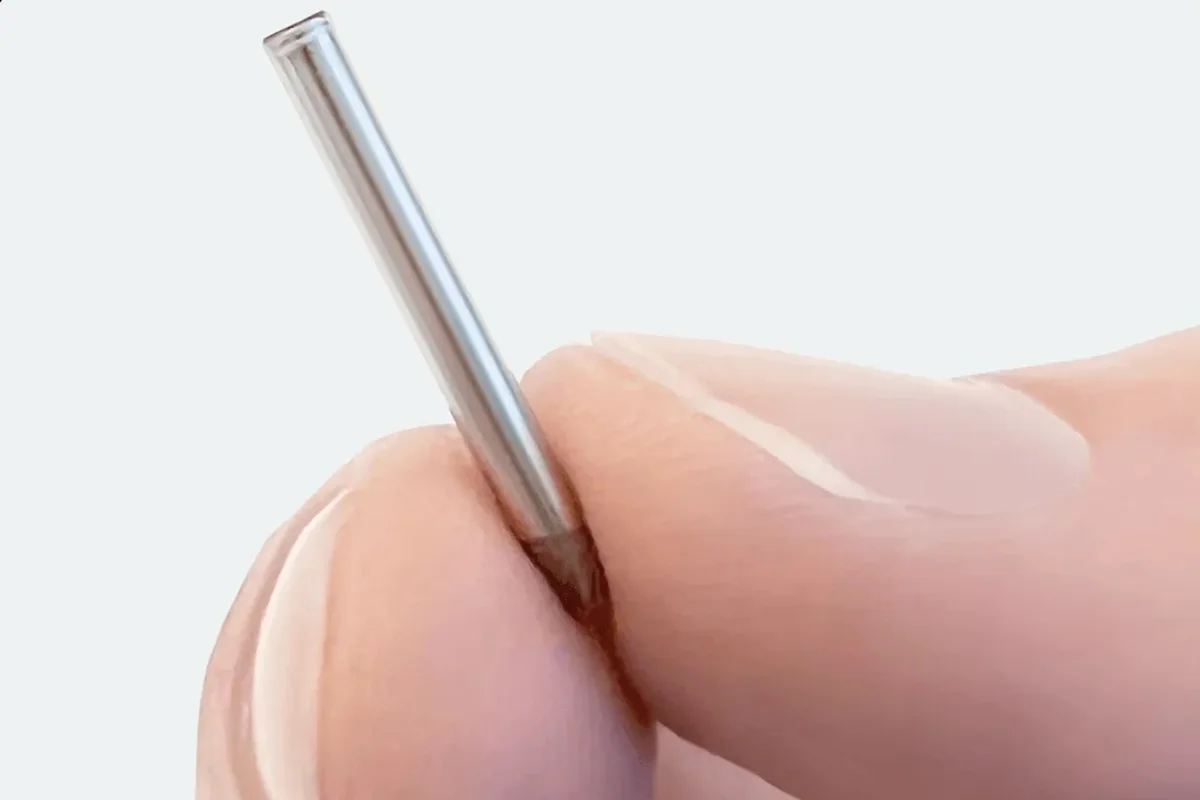 Novo Chip de Semaglutida Pode Resolver Desafios de Tratamento