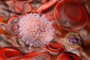 Além desses, existem ainda outros subtipos da doença, como, por exemplo, leucemia mieloide crônica, leucemia linfoide aguda, leucemia linfoide crônica, leucemia de células-T do adulto, leucemia linfocítica granular T ou NK, leucemia agressiva de células NK e leucemia de células pilosas Além desses, existem ainda outros subtipos da doença, como, por exemplo, leucemia mieloide crônica, leucemia linfoide aguda, leucemia linfoide crônica, leucemia de células-T do adulto, leucemia linfocítica granular T ou NK, leucemia agressiva de células NK e leucemia de células pilosas