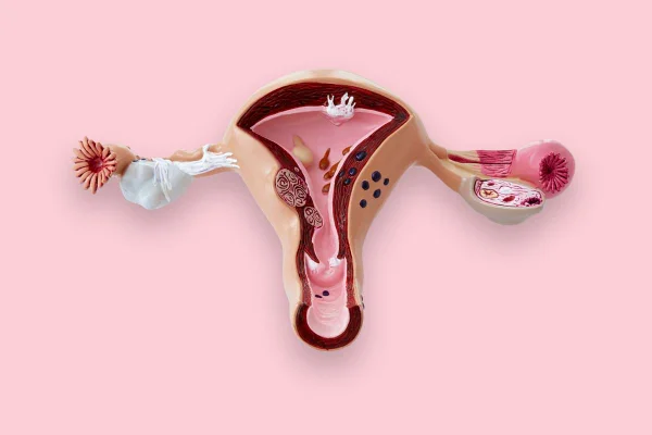 Cólica menstrual