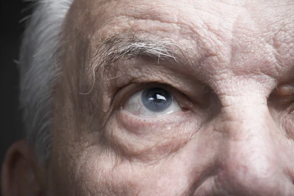 Foto mostra em close up o olho de um senhor idoso