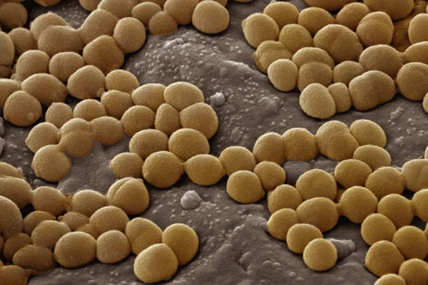 Imagem colorida do Staphylococcus aureus - Metrópoles