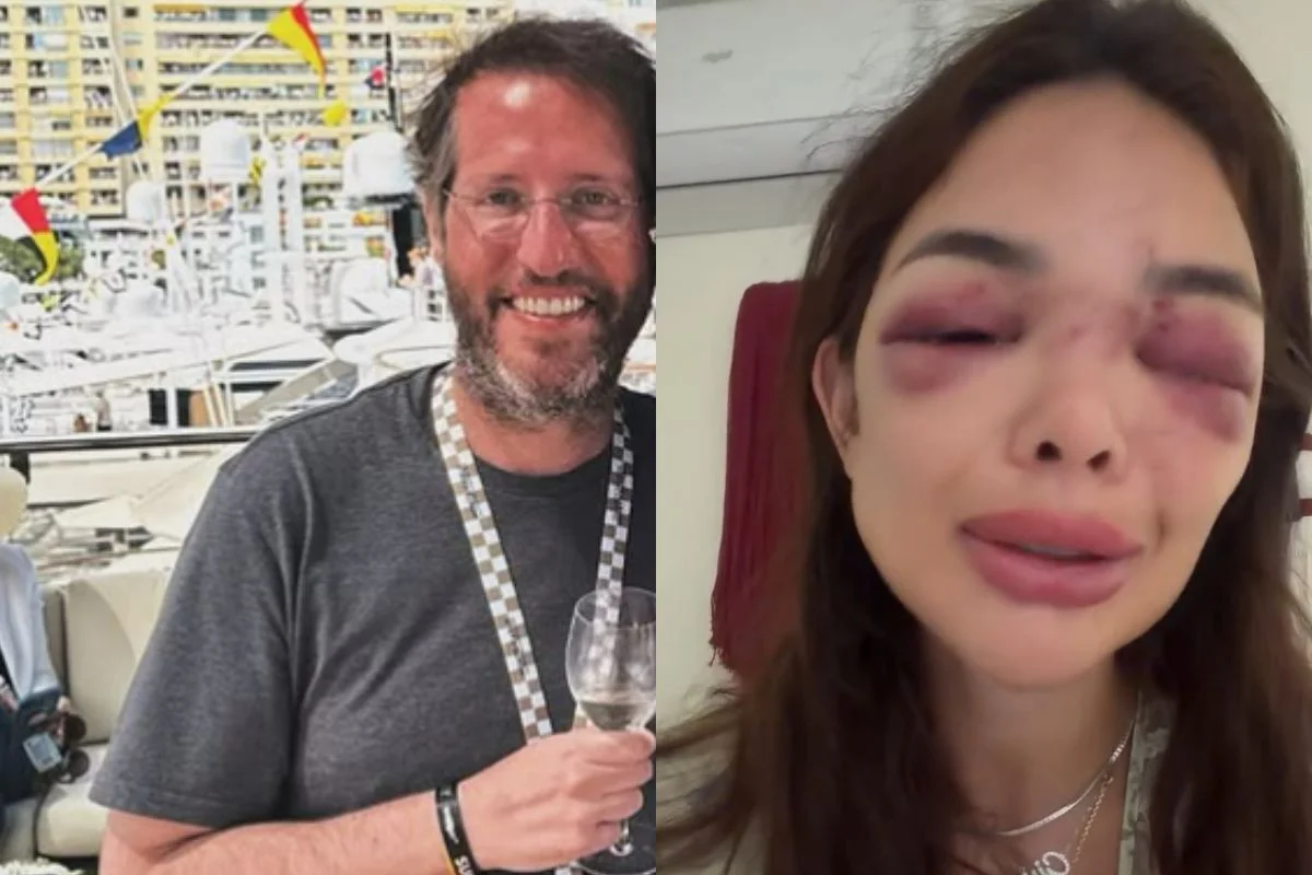 Giullia Kos acusa o marido, Ivo Kos, de agredí-la Giullia Kos acusa o marido, Ivo Kos, de agredí-la