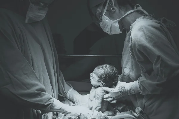 Imagem em preto e branco mostra dois médicos retirando um bebê da barriga da mãe em uma cesárea - Metrópoles