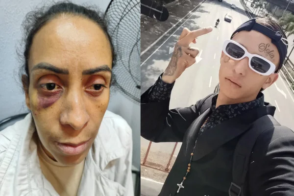 Duas fotos. Esquerda, mulher com o olho roxo e, direita, jovem de óculos escuros mostra o dedo do meio - Metrópoles