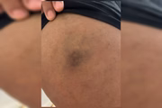 Agressão aconteceu após casal reclamar do cheiro de cigarro e do ar-condicionado Agressão aconteceu após casal reclamar do cheiro de cigarro e do ar-condicionado