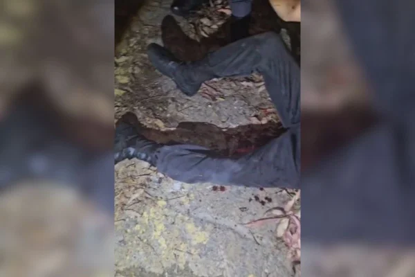 Adolescente de 16 anos ficou ferido após bomba caseira explodir contra si.