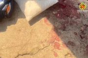 Mulher é esfaqueada pelo marido e filho de 8 anos estanca sangramento - imagem 2 Mulher é esfaqueada pelo marido e filho de 8 anos estanca sangramento - imagem 2