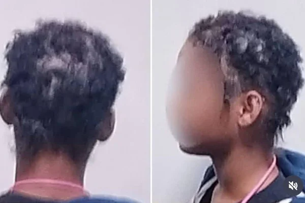 Veja como ficou cabelo cortado de jovem agredida por prima, irmã e tia