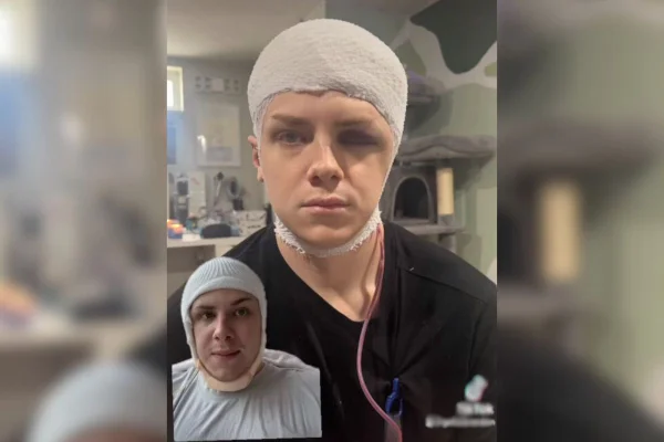 Imagem colorida de rapaz com faixa na cabeça para falar sobre sua cirurgia no crânio - MEtrópoles