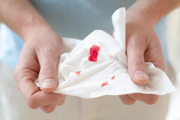 Imagem de pessoa segurando um pedaço de papel com gotas de sangue - Metrópoles