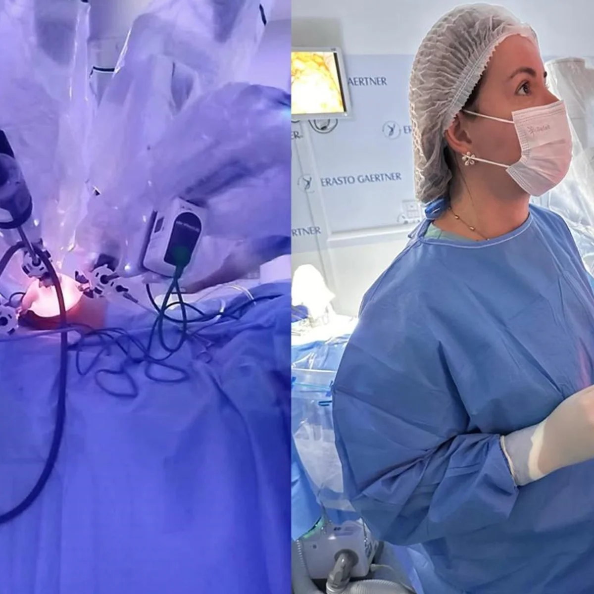 Primeira cirurgia robótica para câncer de mama é realizada
