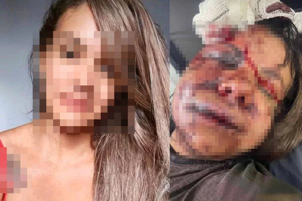 Mulher espancada por ex-jogador de basquete antes e depois