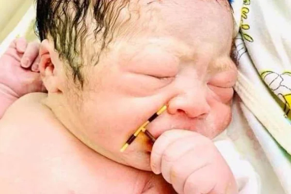 Bebê segurando DIU