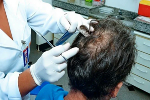 Técnico de labortório colhe amostra de cabelo para teste toxicológico de cnh - Metrópoles