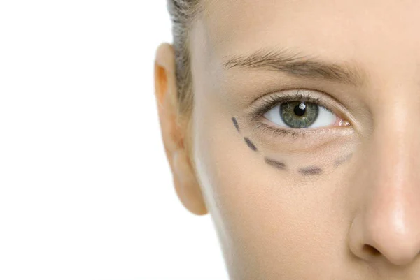 CBV – Hospital de Olhos é referência em cirurgia plástica ocular
